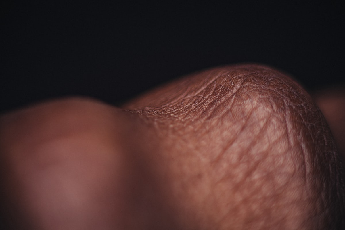Macro close-up of skin showing pores and surface texture against a dark background.
